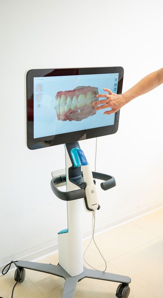 3D Intraoral Scanner